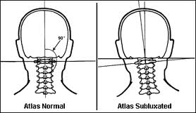 skull_atlas.jpg